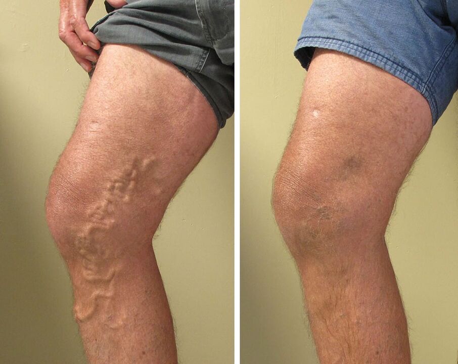 Experience of using ZXCVBNQWERT GEL