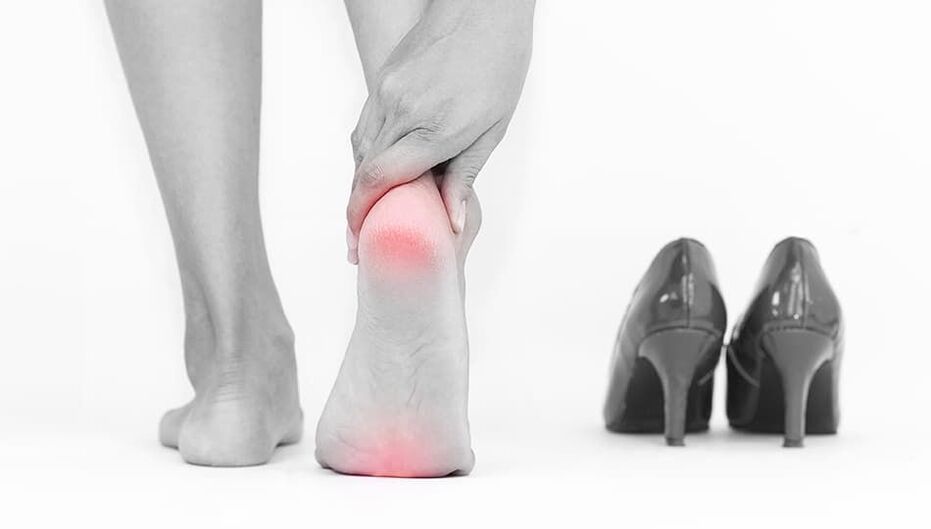 The reason for the apparition of varicose veins is uncomfortable shoes